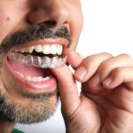 invisalign treatment in Agoura Hills